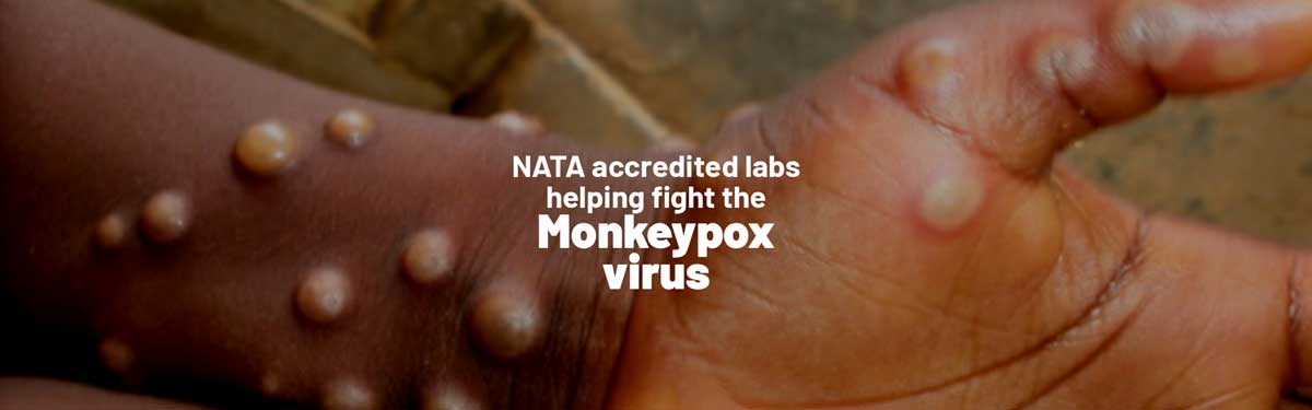 NATA accredited laboratories helping fight the Monkeypox virus