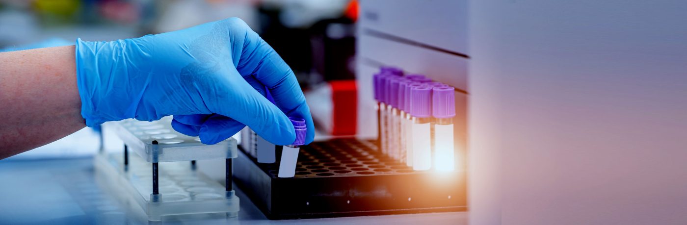 New Industry Guide: Biobanking and the confidence behind every sample